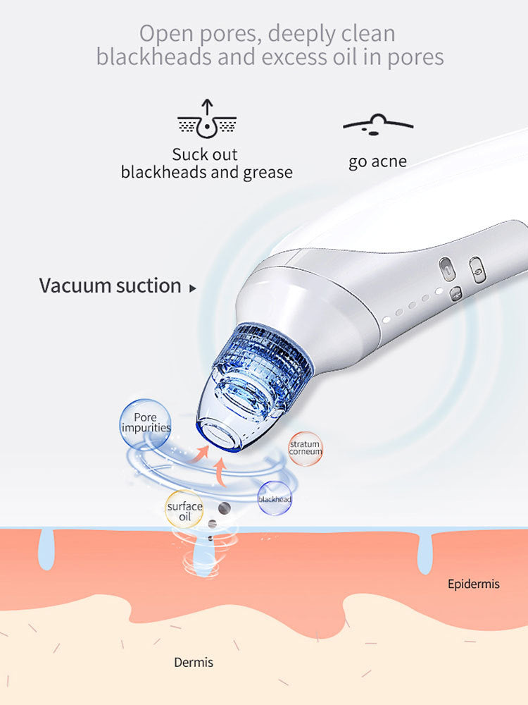 Electric Blackhead Remover Vacuum | Pore Cleaner & Acne Suction Tool | Home Use Beauty Instrument for Blackhead & Acne Removal
