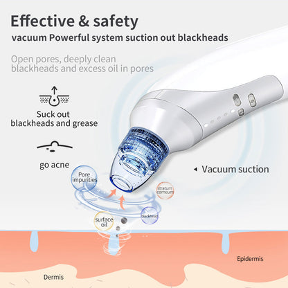 Electric Blackhead Remover Vacuum | Pore Cleaner & Acne Suction Tool | Home Use Beauty Instrument for Blackhead & Acne Removal